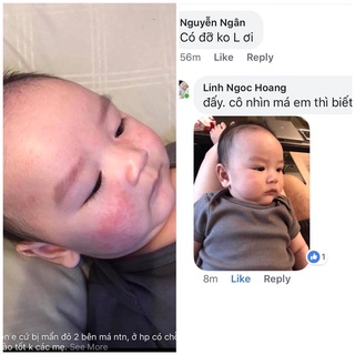BỘ SẢN PHẨM AVEENO CHÀM SỮA
