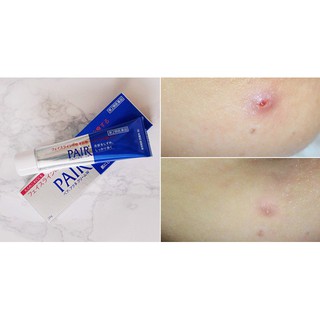 KEM MỤN PAIR NHẬT BẢN 24G