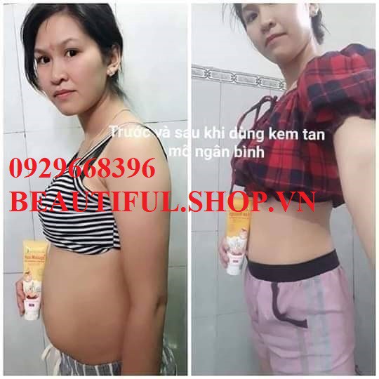 👍[100% Chính Hãng] Kem Tan Mỡ Ngân Bình 150Gr + Tặng Thước Dây + Đánh Bay Mỡ Thừa | BigBuy360 - bigbuy360.vn