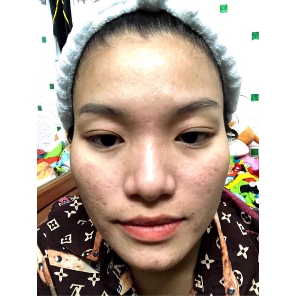 kem dưỡng ẩm cực kỳ tốt | BigBuy360 - bigbuy360.vn