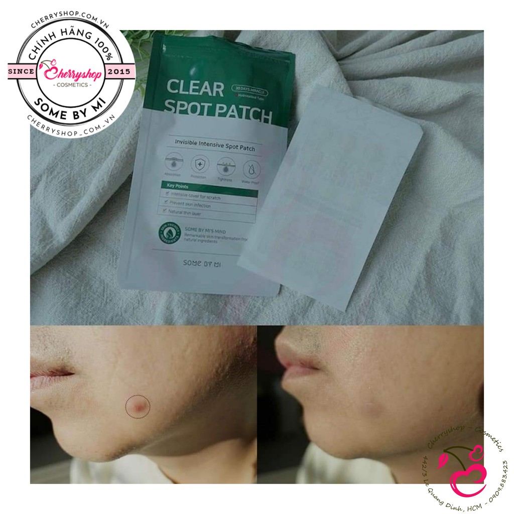 💥🍒Miếng Dán Mụn Some By Mi Clear Spot Patch