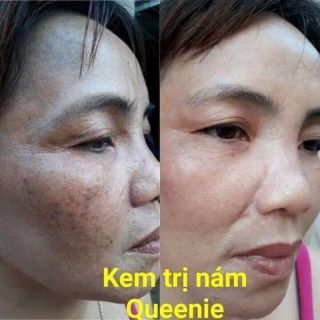 Kem nám Queenie skin