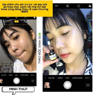 Combo trắng da ( serum tmx x5 & kem face )