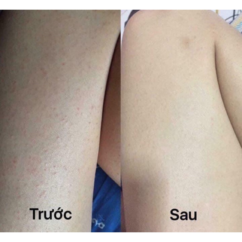 XÀ BÔNG ĐEN Shea Moisture 230g