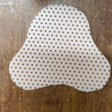 Nẹp cố định mũi sau phẫu thuật