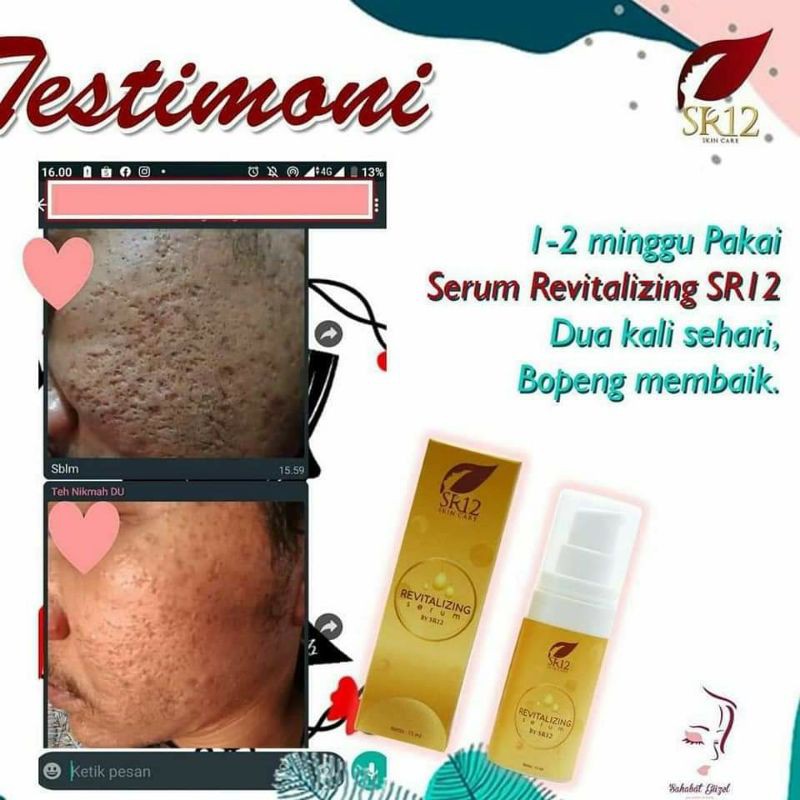 (Hàng Mới Về) Serum Tái Tạo Da Mặt Sr12 Trị Sẹo Mụn