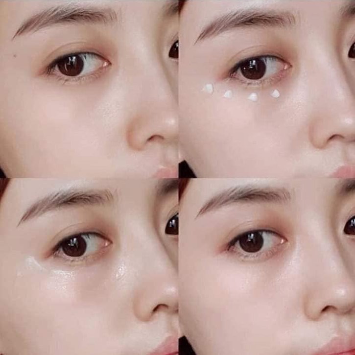 Kem Dưỡng Mắt Chống Lão Hóa Montnature56 Natural Vital Eye Cream | BigBuy360 - bigbuy360.vn