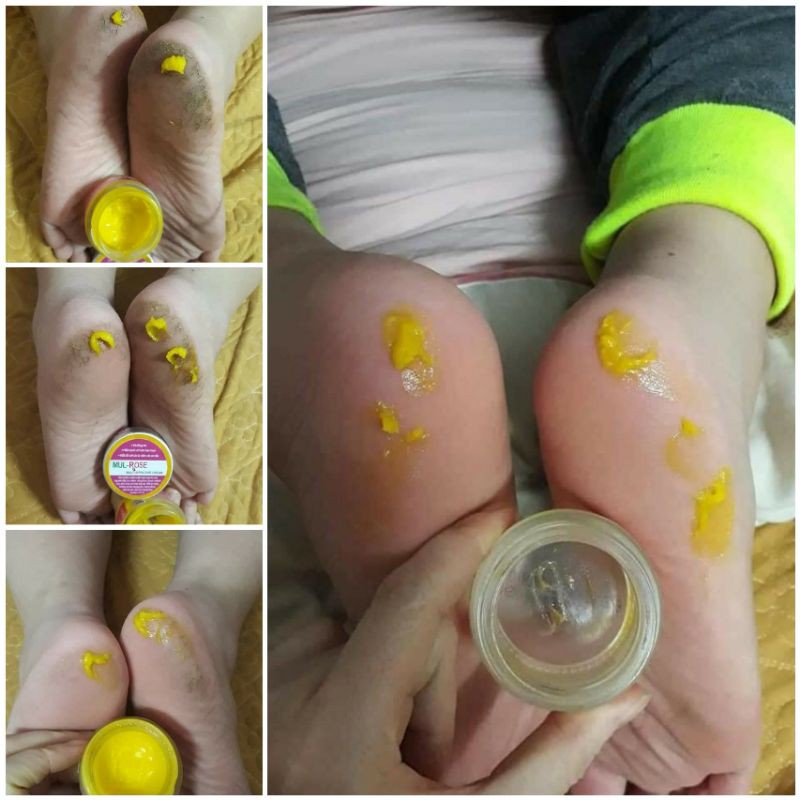 Kem Đa Năng Mul Rose 30g (Chính Hãng)❤Tặng Kèm Serum Của Hãng | BigBuy360 - bigbuy360.vn