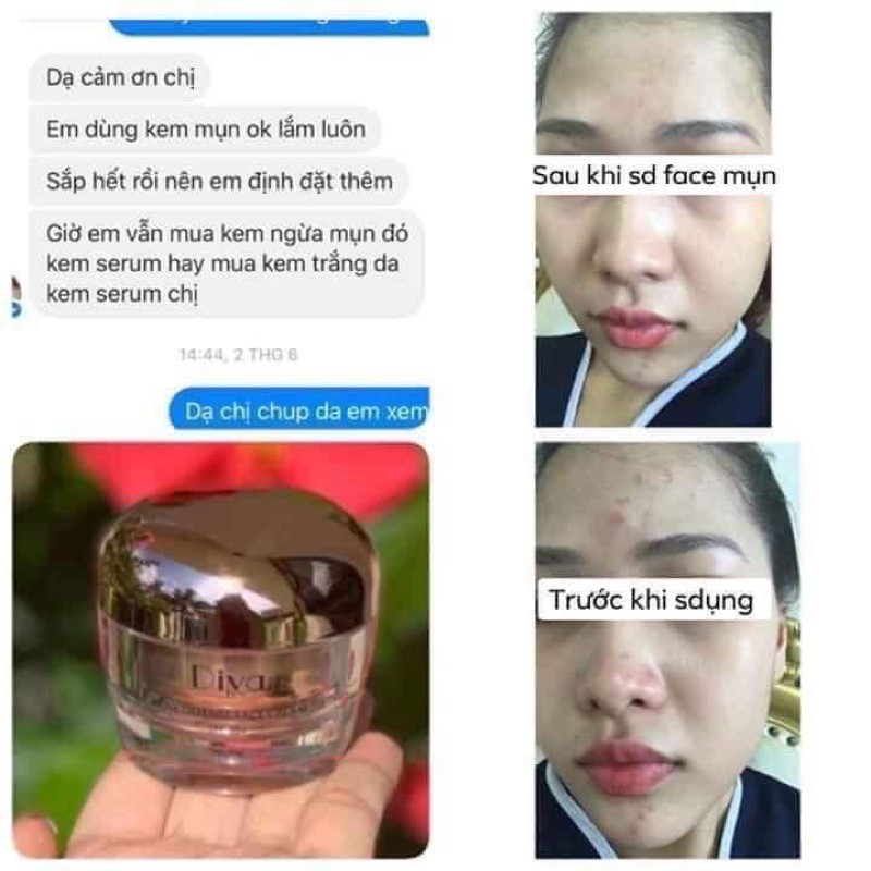 Kem Face MỤN cao cấp DIVA LYN Hàn Quốc | BigBuy360 - bigbuy360.vn