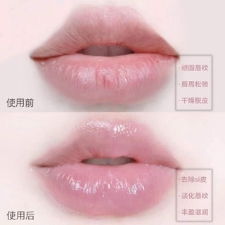 Mặt Nạ Môi Vaseline Dưỡng Ẩm Chăm Sóc Môi 7g