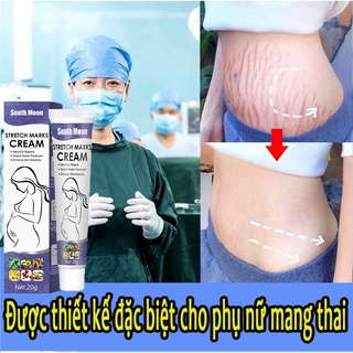 Kem xoá rạn da sau sinh, làm mờ vết thâm, sáng đều màu da, cải thiện sẹo lâu năm, kem phục hồi săn chắc, xóa rạn da do béo phì 20g