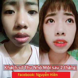 Tinh Chất Thon Gọn Môi Miracle