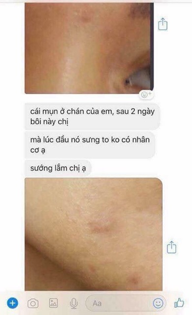 Chấm mụn clinda-m thái lan | BigBuy360 - bigbuy360.vn