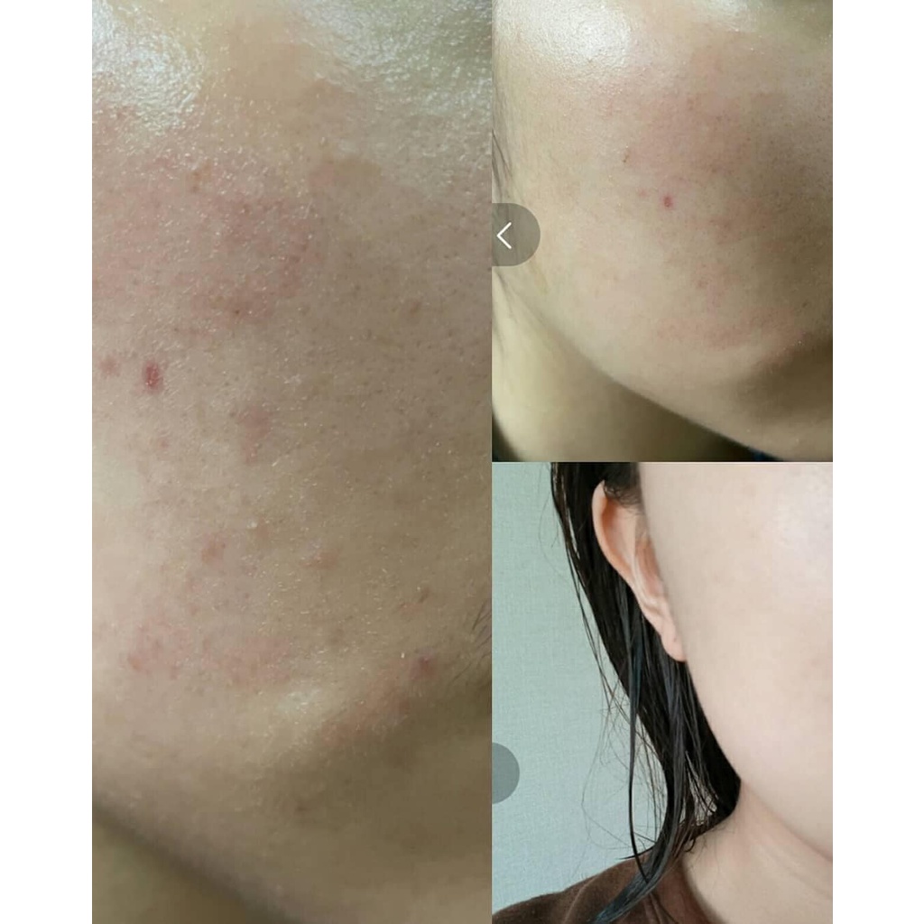 Tinh Chất B5 Dưỡng Ẩm Make P:rem Comfort Me Panthenol Moisture Essence