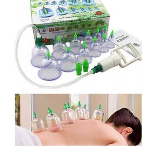 Bộ Giác Hơi 12 Ông Kèm Hút Chân Không