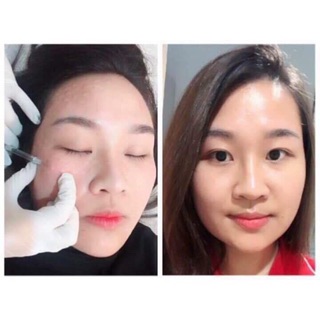DNA Cá Hồi Placentex