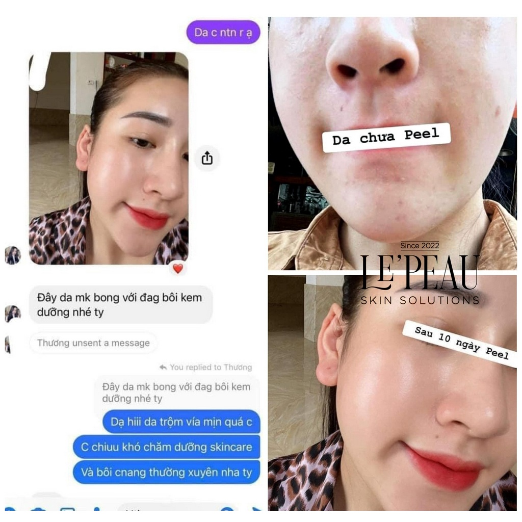 LE’PEAU peel vi tảo