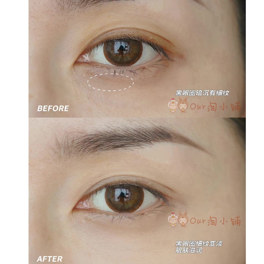 Kem dưỡng da mắt phục hồi CLARINS cô đặc 2 trong 1 cấp ẩm làm săn chắc da 20ml