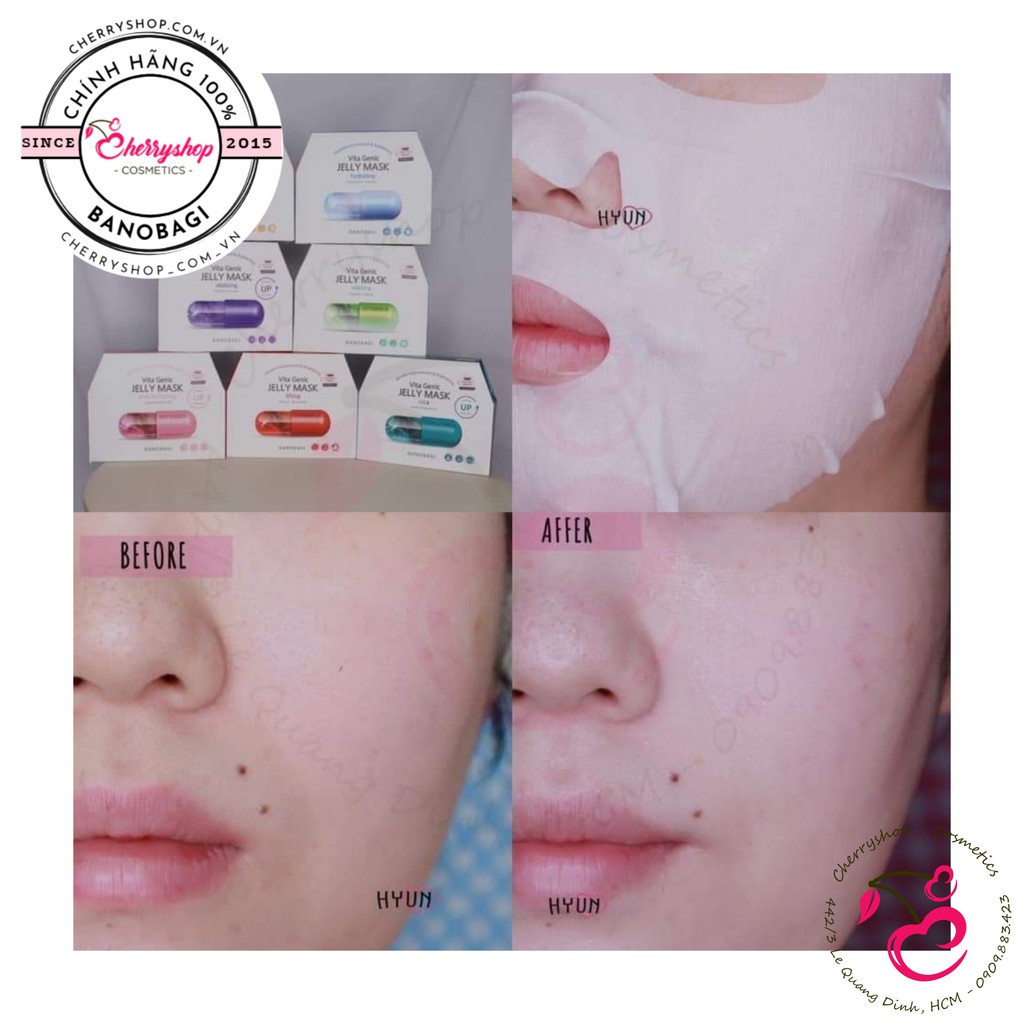 Mặt nạ thuốc Banobagi Vita Genic Jelly Mask | Thế Giới Skin Care