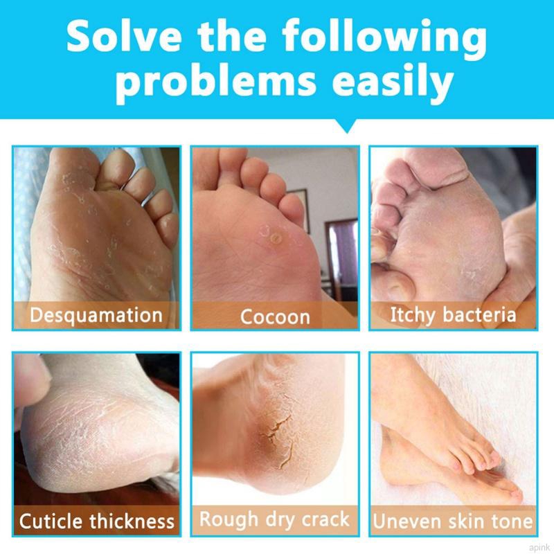 Mặt Nạ Chân ALIVER Chiết Xuất Sữa Tẩy Tế Bào Chết Dưỡng Ẩm Làm Mềm Da