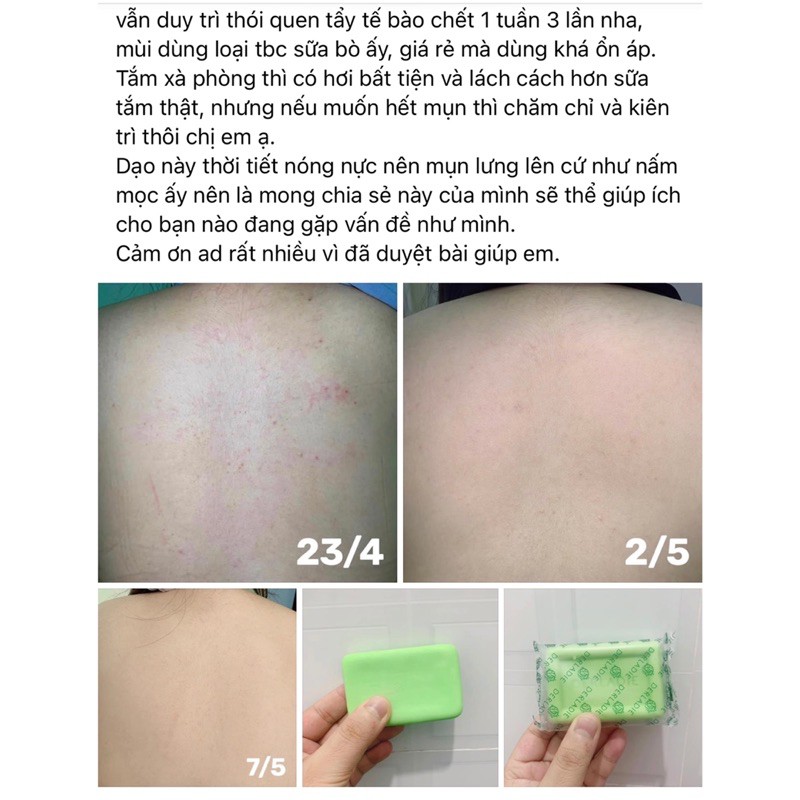 Xà Phòng Derladie - Xà Bông Mụn Lưng Cơ Thể Derladie Body Cleansing Bar For Blemish Skin