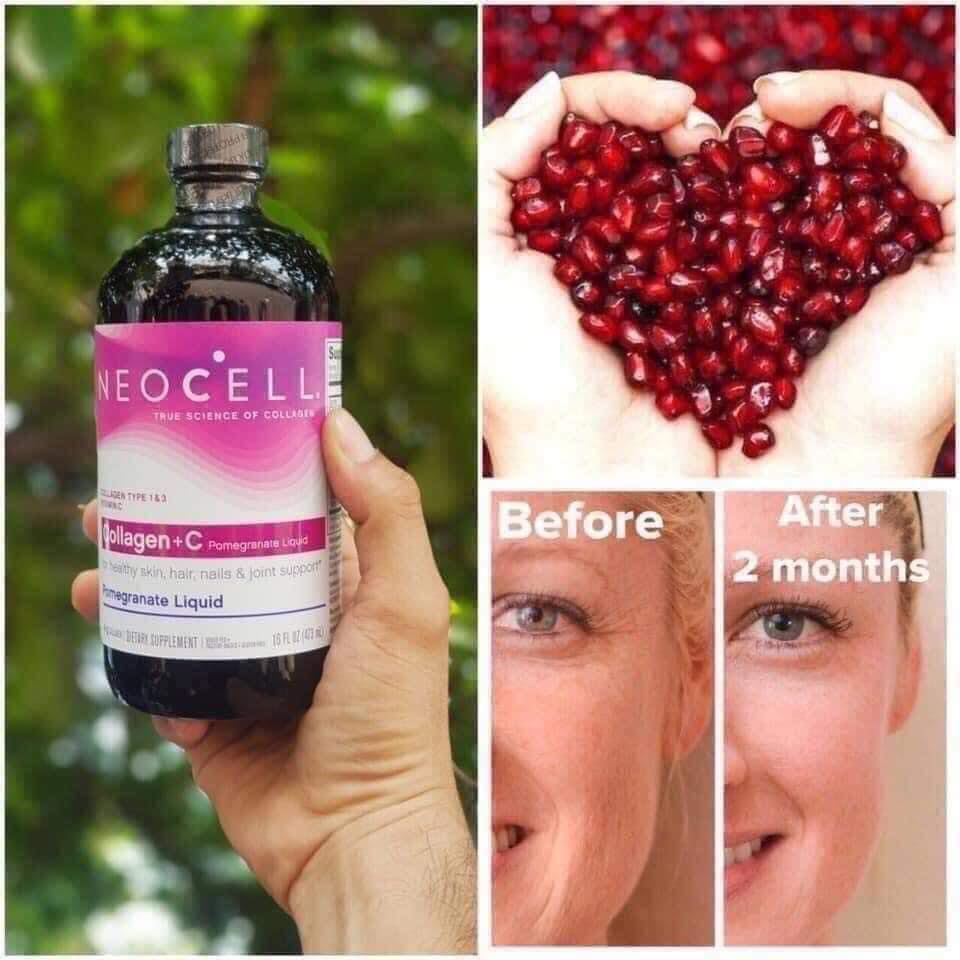 Nước Uống Collagen Lựu Giúp Da Mịn Màng, Chống Lão Hóa NeoCell Collagen + C Pomegranate Liquid 4000mg 473ml
