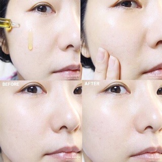 Eldas serum tế bào gốc