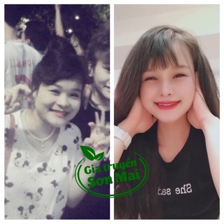 TAN MỠ SƠN MAI