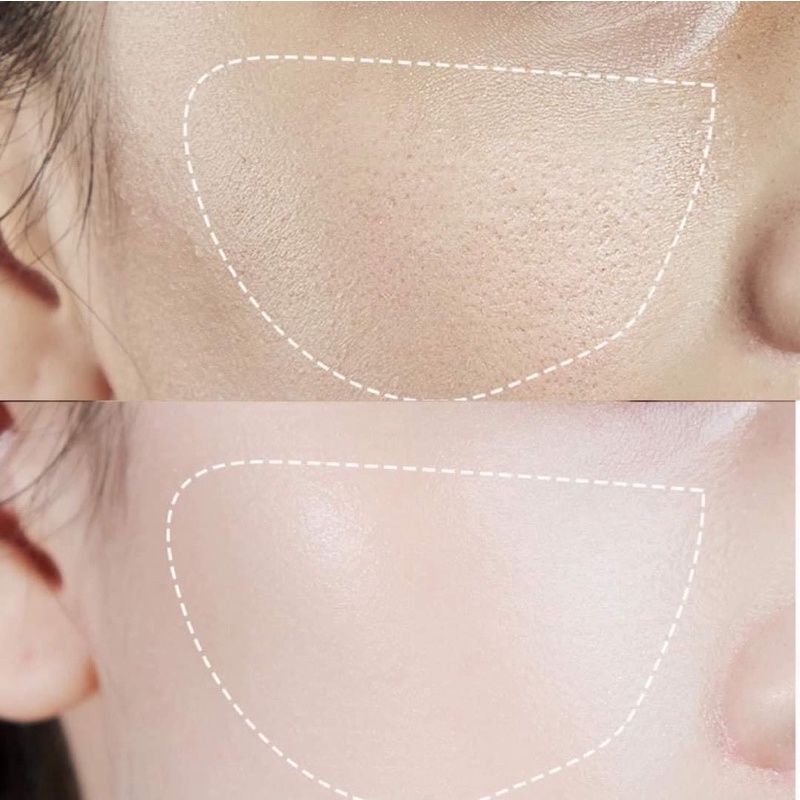 SERUM VÀ KEM DƯỠNG MEDIPEEL BORTOX PEPTIDE CĂNG BÓNG DA