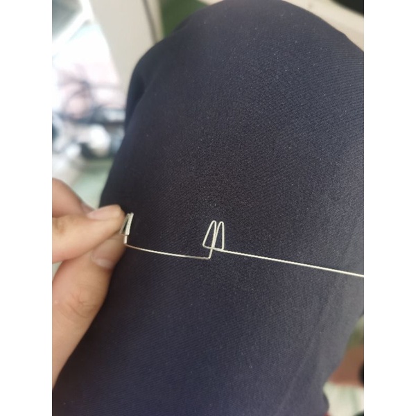 Loop Double Delta,  đóng khoảng kéo lui 4 răng cửa, chỉnh nha Bio