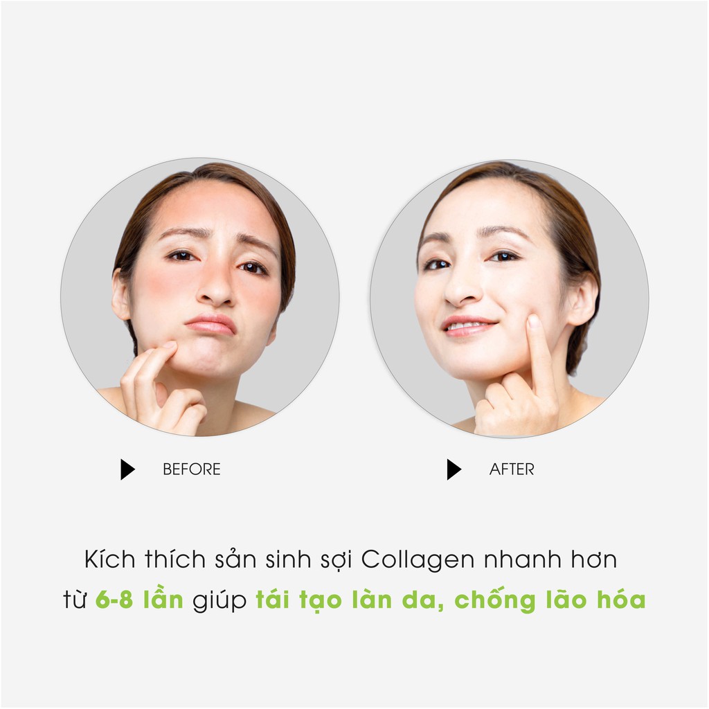 Combo 2 Gel Lô Hội Dưỡng Ẩm Đa Năng & Làm Mềm Da Từ Nha Đam Tươi MILAGANICS 300ml/ Hũ | BigBuy360 - bigbuy360.vn