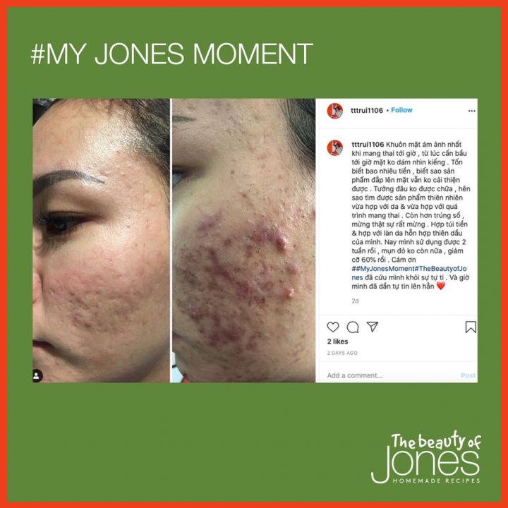 Sữa Rửa Mặt Cho Da Nhạy Cảm The Beauty Of Jones 100ml Và 20ml