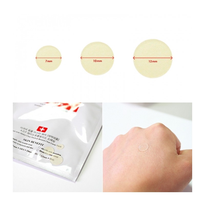 [Chính Hãng 100%] Miếng Dán Mụn Cosrx Acne Pimple Master Patch