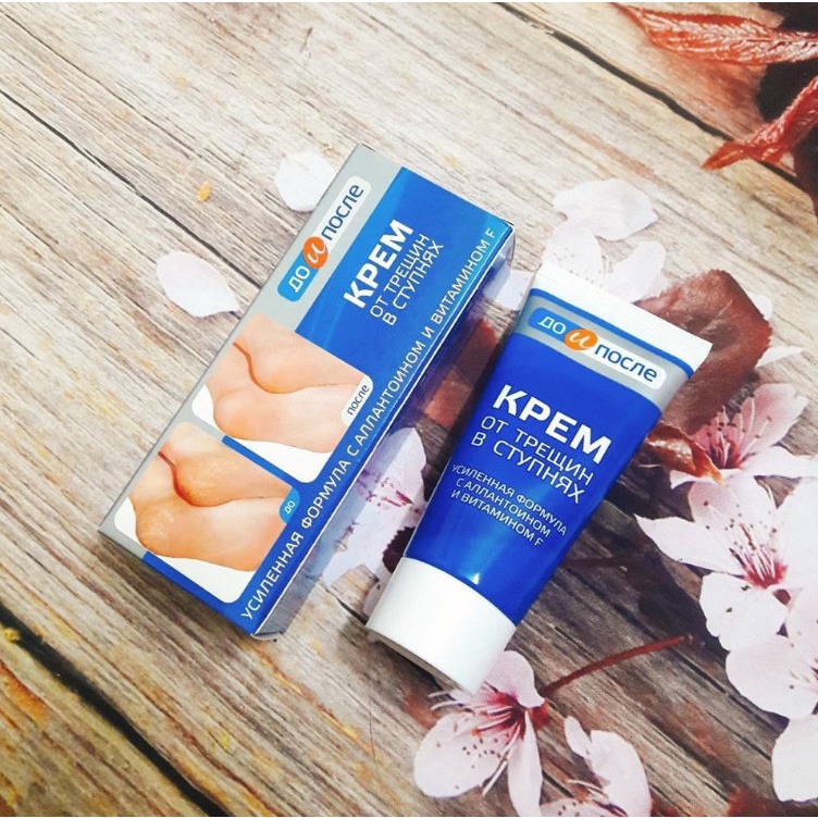 Kem nẻ gót chân Kpem Foot Cream Nga giảm nẻ chân nứt chân khô da chân dưỡng gót chân - [𝐓𝐚̣̆𝐧𝐠 𝐦𝐚́𝐲 𝐦𝐚𝐬𝐬𝐚𝐠𝐞 𝐦𝐚̣̆𝐭]