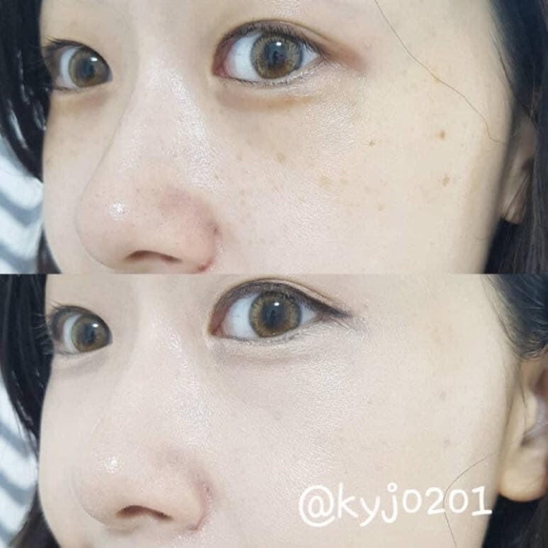 Phấn nước Apieu Wonder Tension Pact | BigBuy360 - bigbuy360.vn