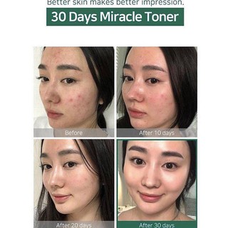 Toner AHA – BHA – PHA 30 Days Miracle Toner