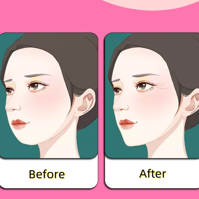 Băng Quấn Tạo Khuôn Mặt V-Line Bằng TPU Thoáng Khí Chất Lượng Cao