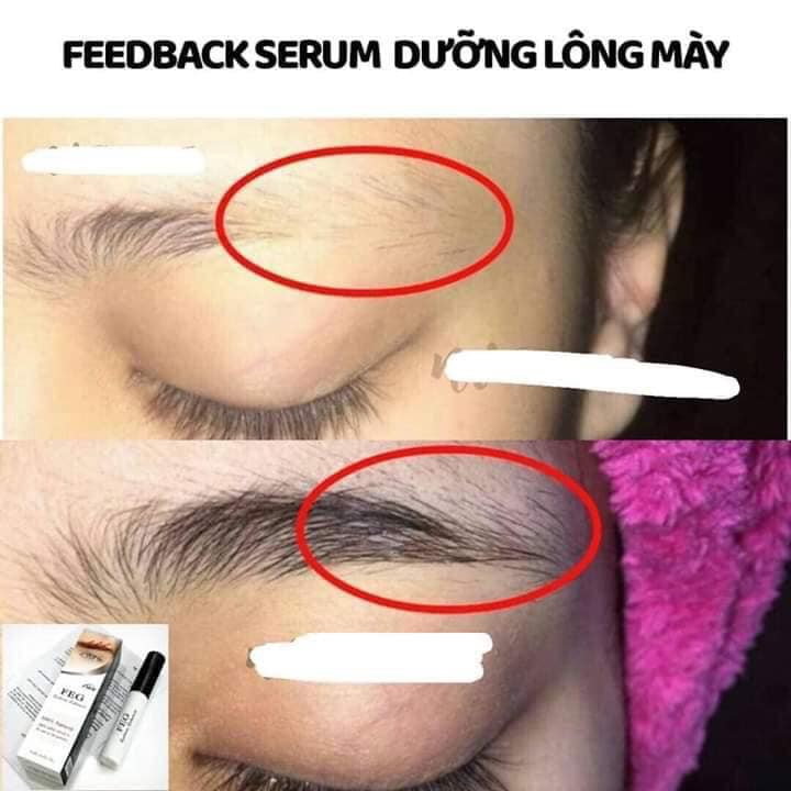 SERUM DƯỠNG MÀY FEG GIÚP ĐEN MÀY , DÀY MÀY , DÀI MÀY - HÀNG CHUẨN CAM KẾT HIỆU QUẢ | BigBuy360 - bigbuy360.vn