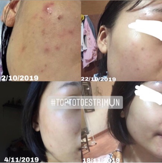Essence Eveline Hyaluron Clinic B5 & tinh chất rau má Centella làm dịu, dưỡng ẩm, phục hồi da | BigBuy360 - bigbuy360.vn