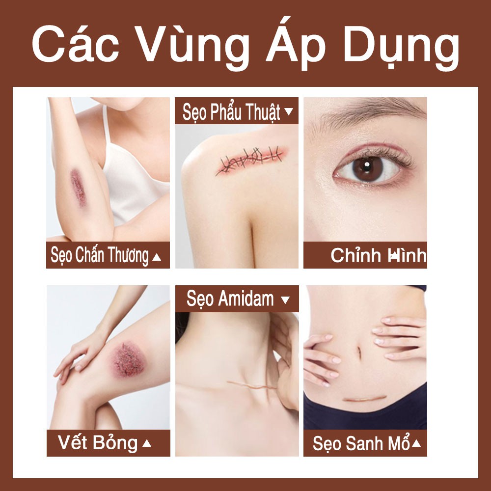 VIBRANT GLAMOUR KEM LÀM MỜ SẸO LÀM MỜ SẸO DO MỤN PHỤC HỒI VÀ TÁI TẠO DA MỜ RẠN DA SAU SINH SCAR TREATMENT GEL