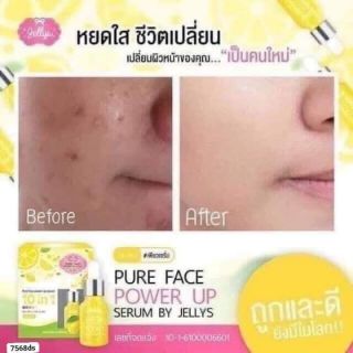 Serum chanh  10 in 1 Thái Lan