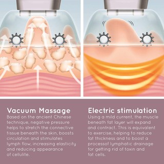 Máy Massage Hút Chân Không HoMedics CELL-500-EU