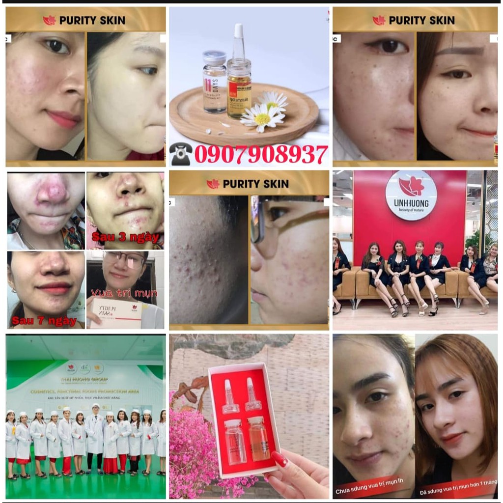 Combo mụn Linh Hương[Chính hãng] Sáng da ngừa mụn | BigBuy360 - bigbuy360.vn