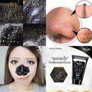 Gel Lột Mụn RONDA THÁI LAN