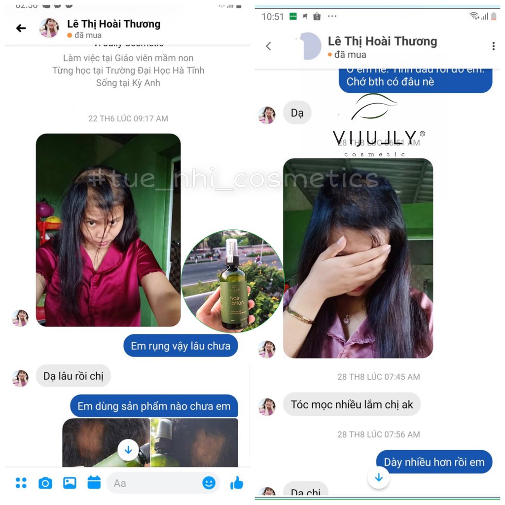 [Chính hãng]Tinh Dầu Xịt Bưởi Vijully Kích Mọc Tóc, Ngăn Ngừa Rụng Tóc | BigBuy360 - bigbuy360.vn