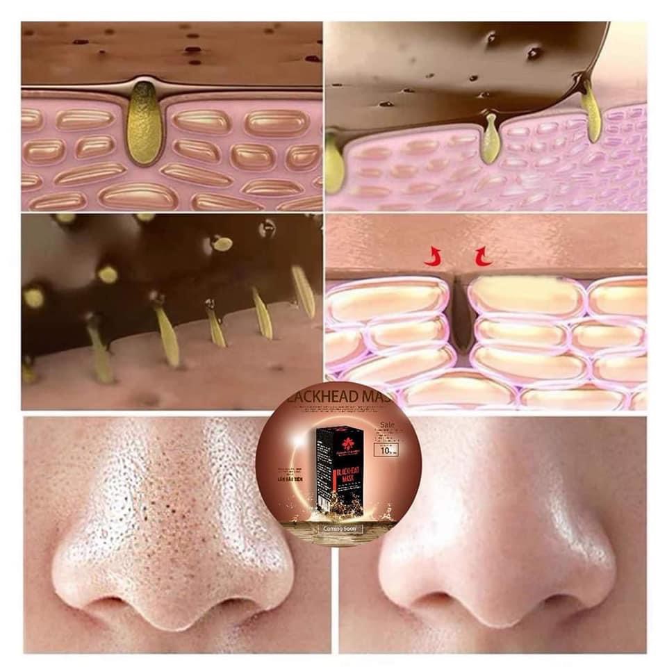 [ CHÍNH HÃNG ] Lột mụn mũi BLACKHEAD MASK chai to 18ml | BigBuy360 - bigbuy360.vn