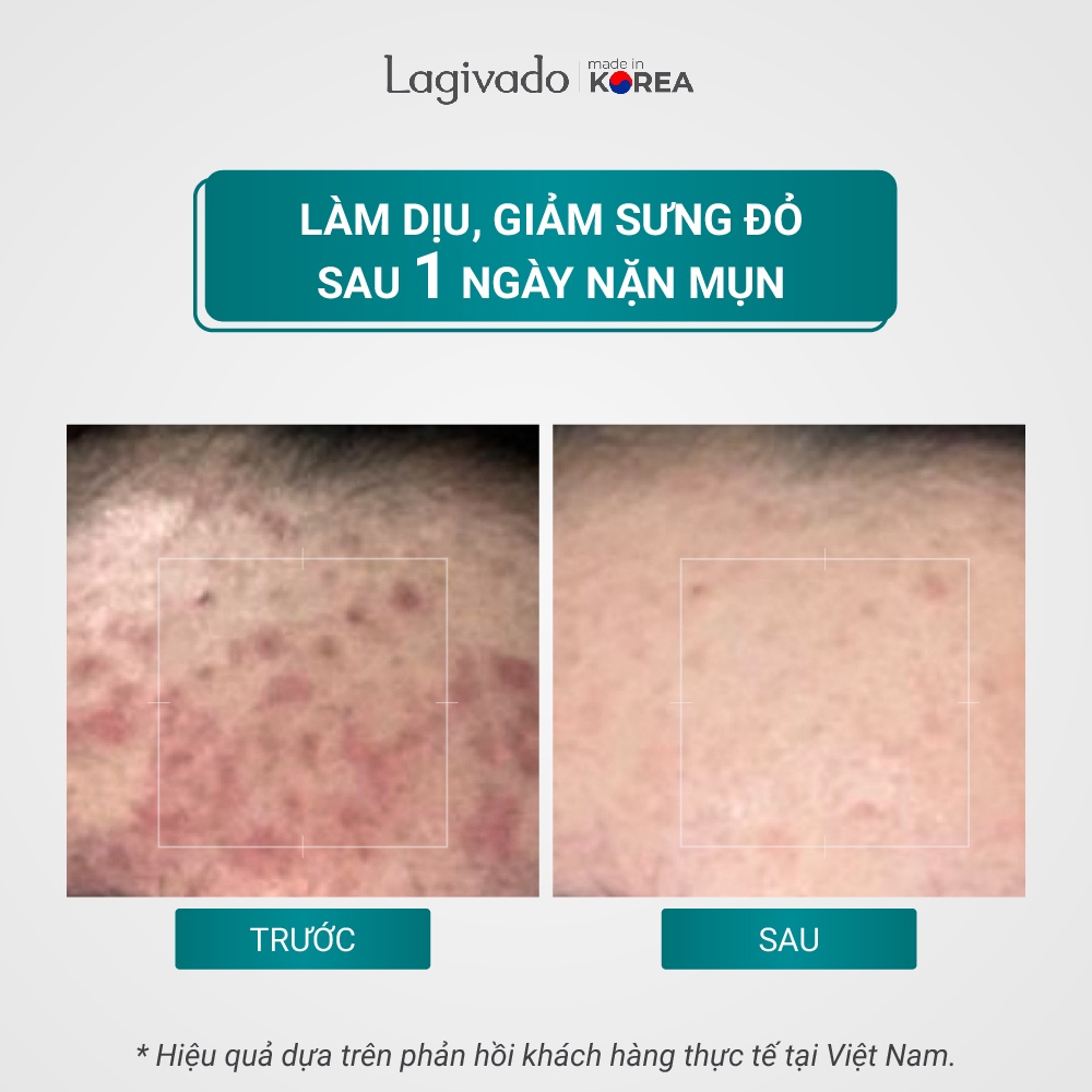 [Hàng chính hãng] - Tinh chất serum giảm mụn, mờ thâm Hàn Quốc Lagivado Dr. ATreat Serum 30 ml