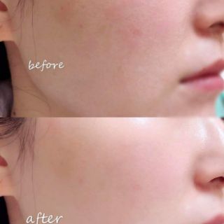 TINH CHẤT VITAMIN C NGUYÊN CHẤT CLINIQUE