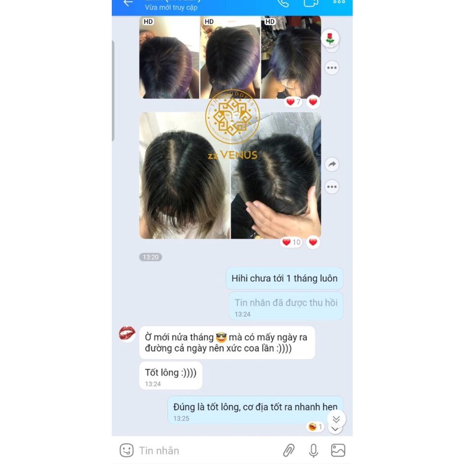 [Chính Hãng] Serum Kích mọc tóc King Venus SR001 100% Thiên nhiên Kích tuần hoàn máu mọc tóc con ngăn ngừa gãy rụng