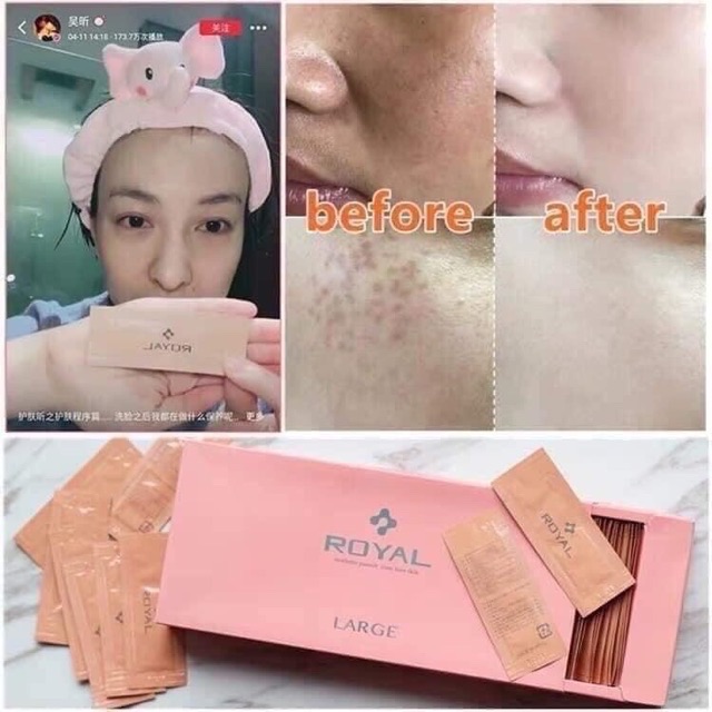 SERUM NHAU THAI CỪU ROYAL NHẬT . . .